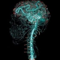 Dr. Wasim Rashid/TMS Therapy - TMS Clinic in Warwick, RI